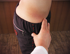 전상 장골극과 대전자 촉진